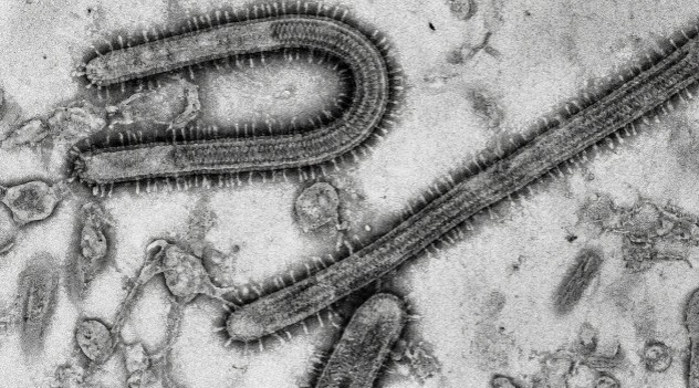 Ebola (File)